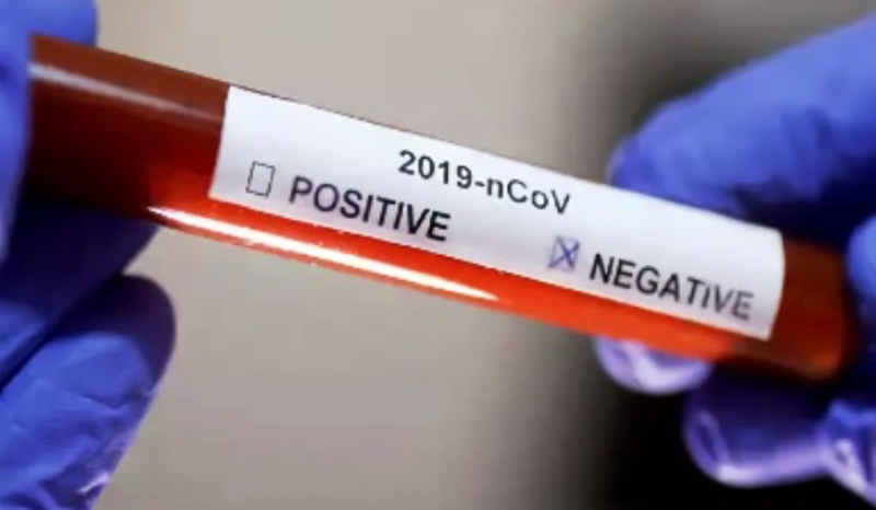 تجاوز عدد حالات كورونا الـ400 ألف حالة في جنوب افريقيا